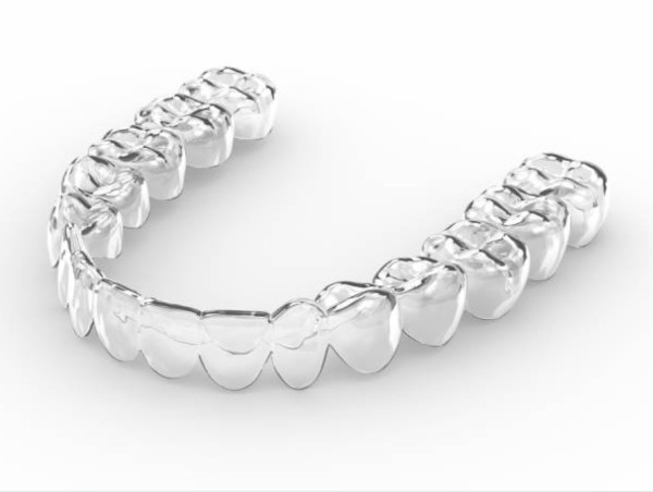 Aligneurs transparents sur mesure : prix d'un traitement par gouttières