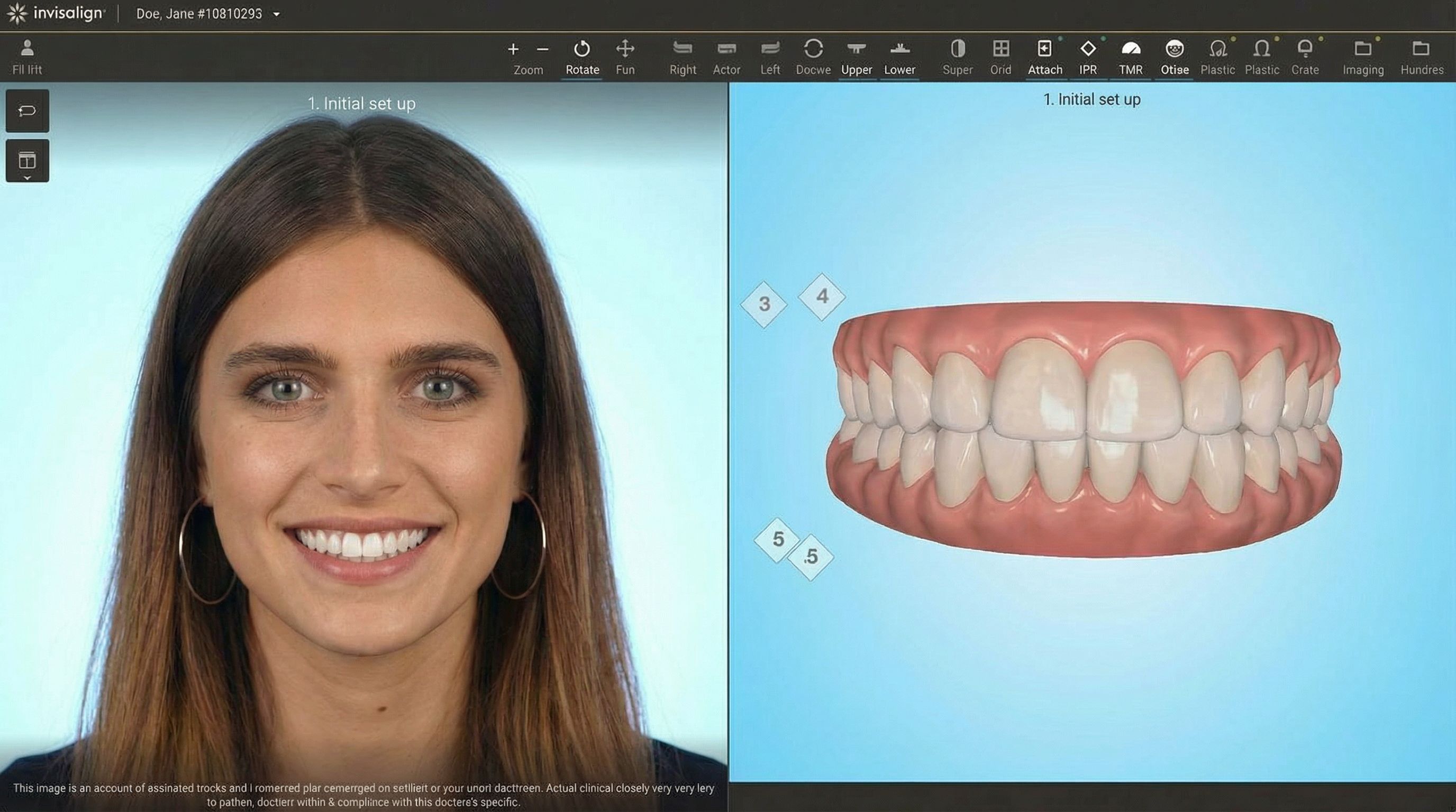 Interface du logiciel ClinCheck