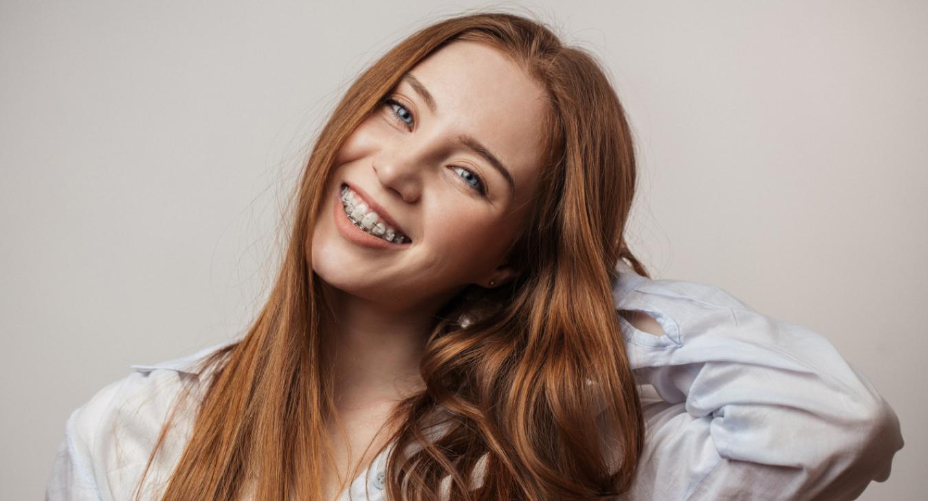 Appareil dentaire adulte en bagues céramique de la couleur des dents
