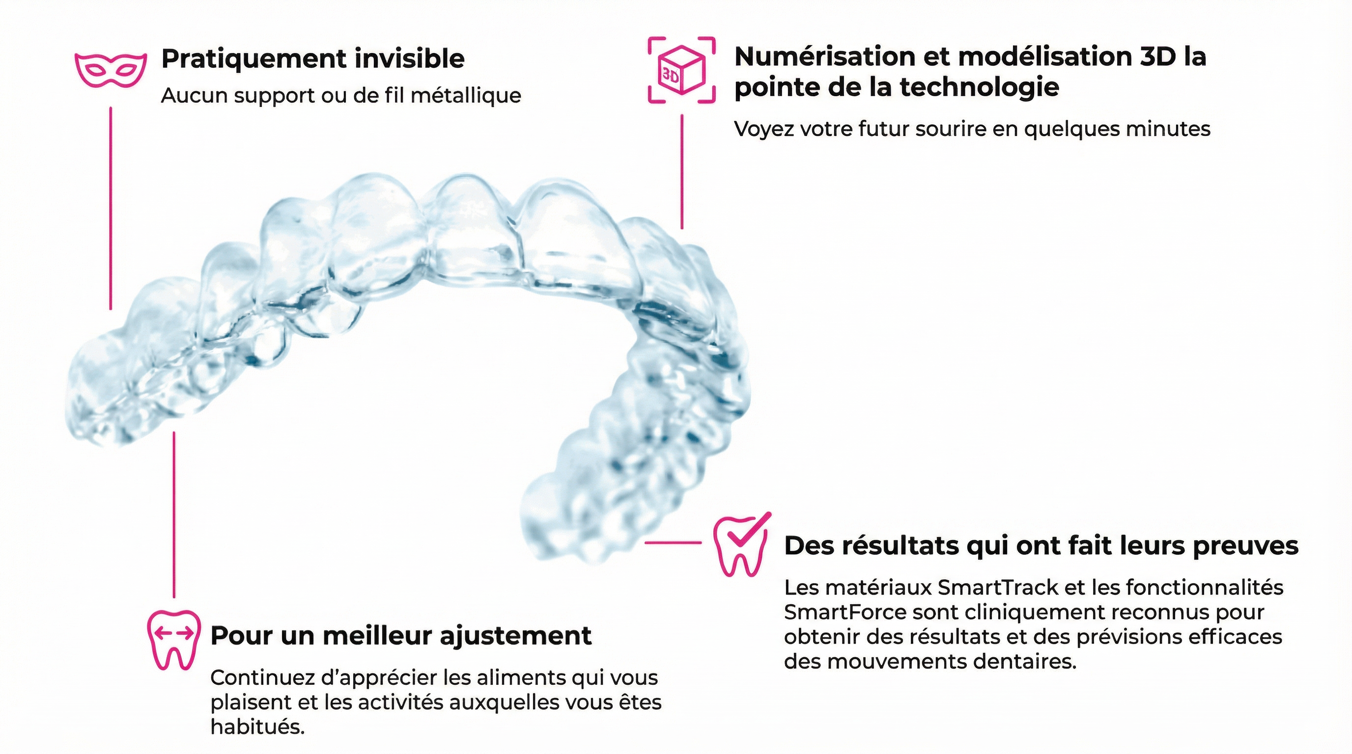 Schéma technique des aligneurs Invisalign
