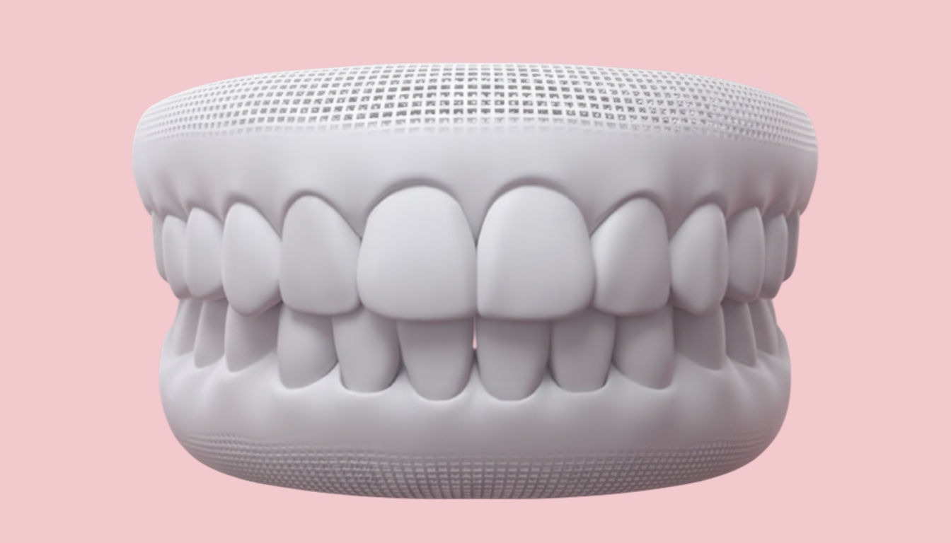 Supraclusion : les dents du haut recouvrent excessivement les dents du bas