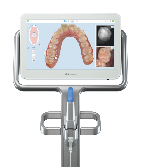 Scanner intra-oral iTero 
